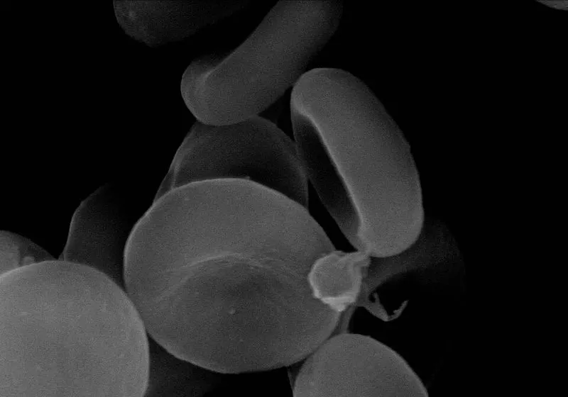 Red blood cells seen with an electron microscope