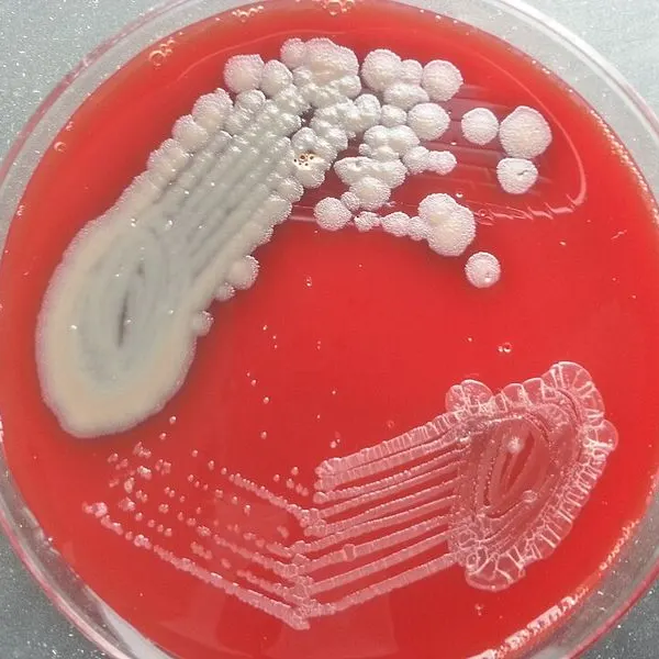 Bacteria growing as colonies on a red agar plate