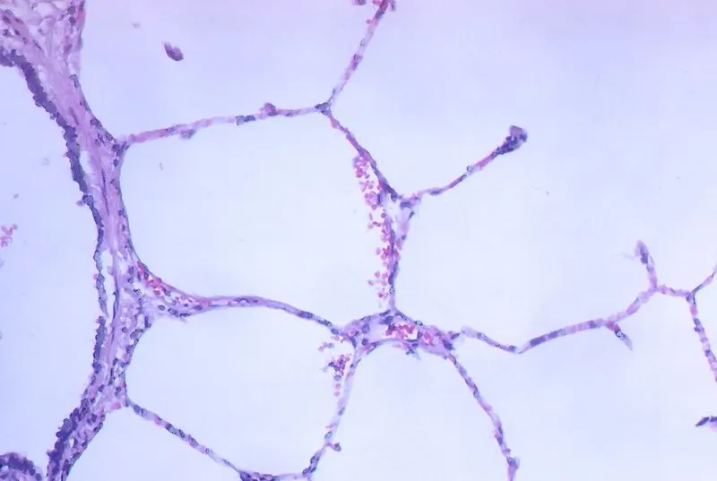 Lung tissue seen under a microscope, showing air sacs