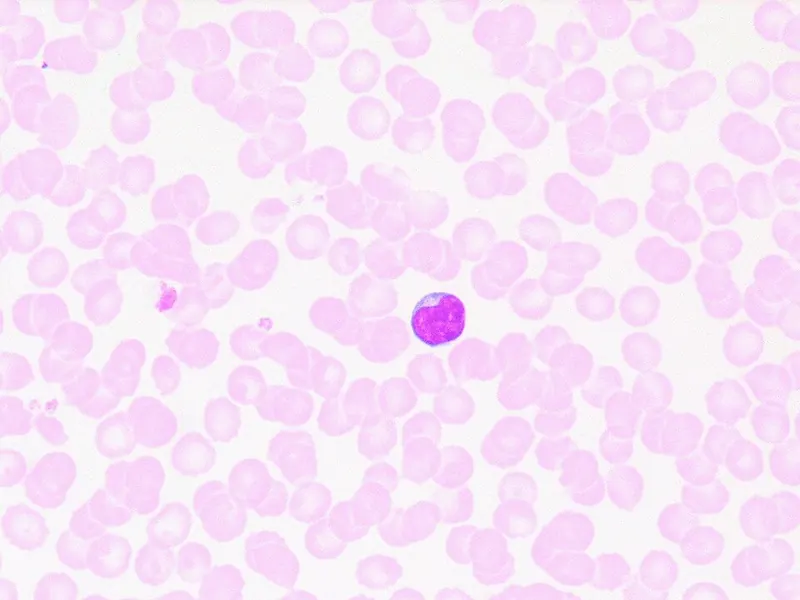 Stained blood seen through a light microscope