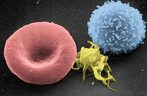 Electron microscope image of a red blood cell, a white blood cell and a platelet