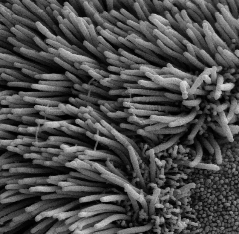 Cilia on the lining of an airway, seen with an electron microscope
